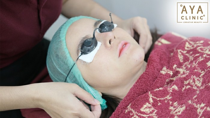 เลเซอร์หน้าใสดีไหม