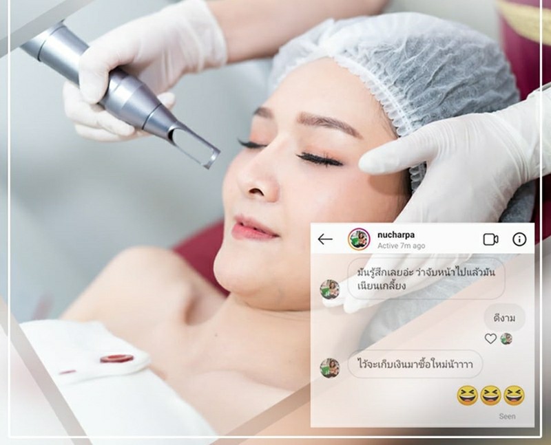 รีวิวเลเซอร์หน้าใส