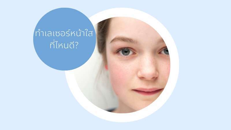 เลเซอร์หน้าใส