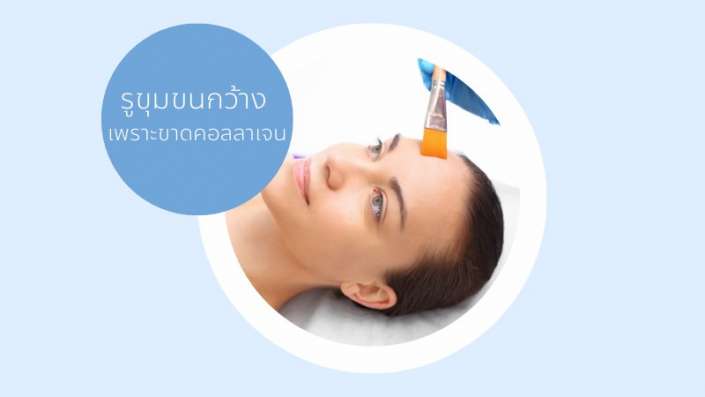 รูขุมขนกว้าง รูขุมขนกว้าง