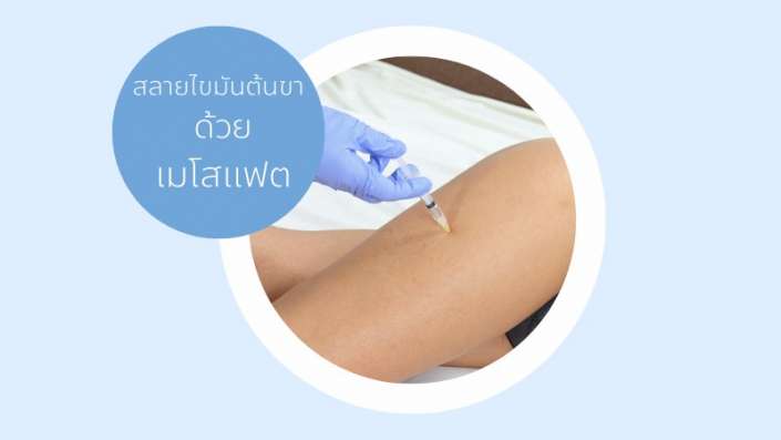 ลดต้นขา เมโสแฟต MESOFAT ลดต้นขา เมโสแฟต MESOFAT