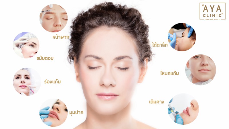 ฉีดฟิลเลอร์แก้มตอบดีไหม
