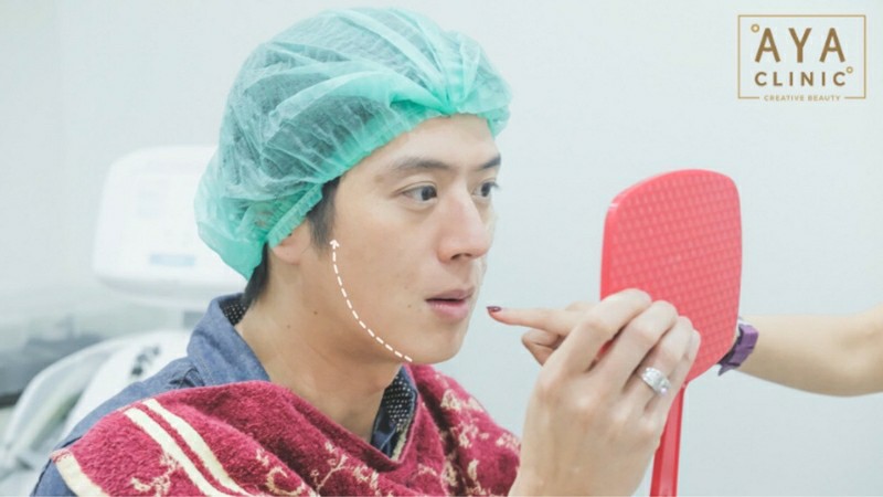 Hifu ที่ไหนดี