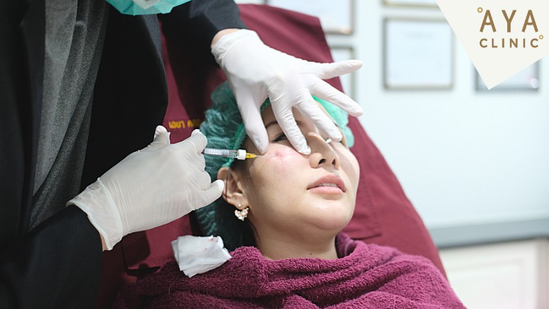 ฉีดฟิลเลอร์ใต้ตา