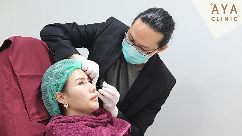 ฉีดฟิลเลอร์ใต้ตาที่ไหนดี