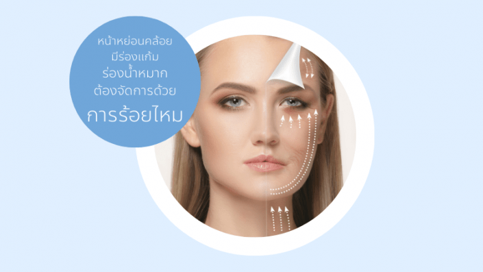 ร้อยไหม4 การร้อยไหม