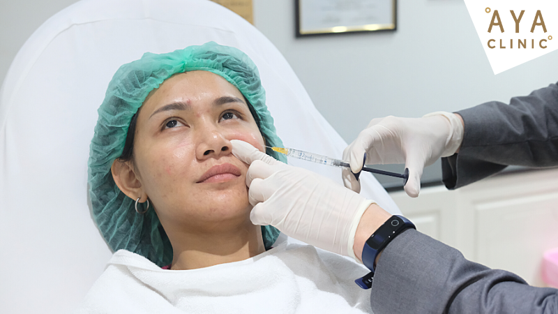 ฉีดฟิลเลอร์แก้มตอบ