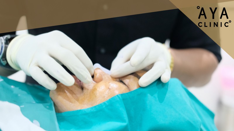 เสริมจมูกที่ไหนดี ราคาไม่แพง