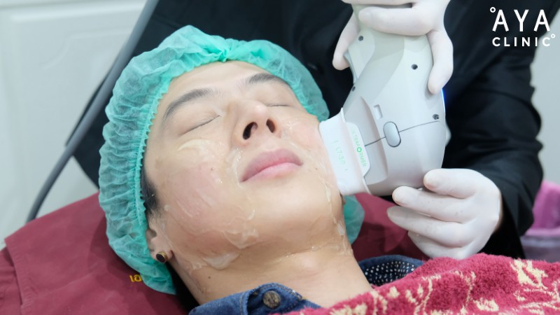 hifu ที่ไหนดี