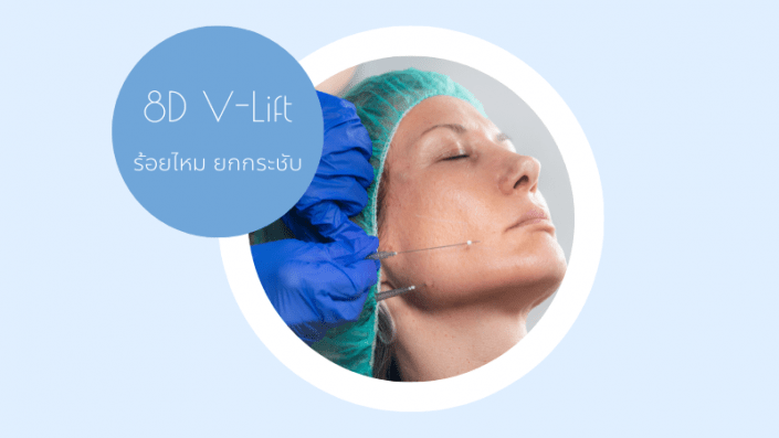 ร้อยไหม 8D