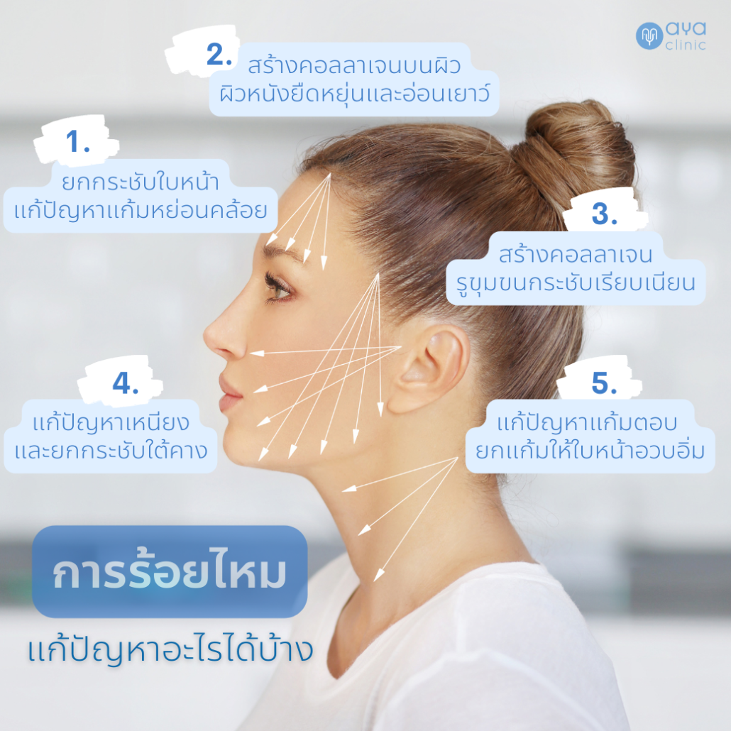 การร้อยไหมแก้ปัญหาอะไรบ้าง