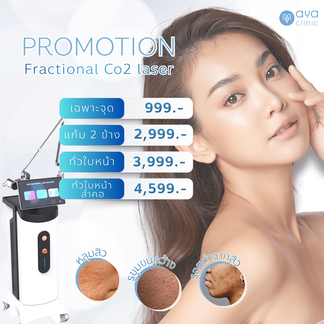 รักษาหลุมสิวด้วย Fractional Co2 Laser