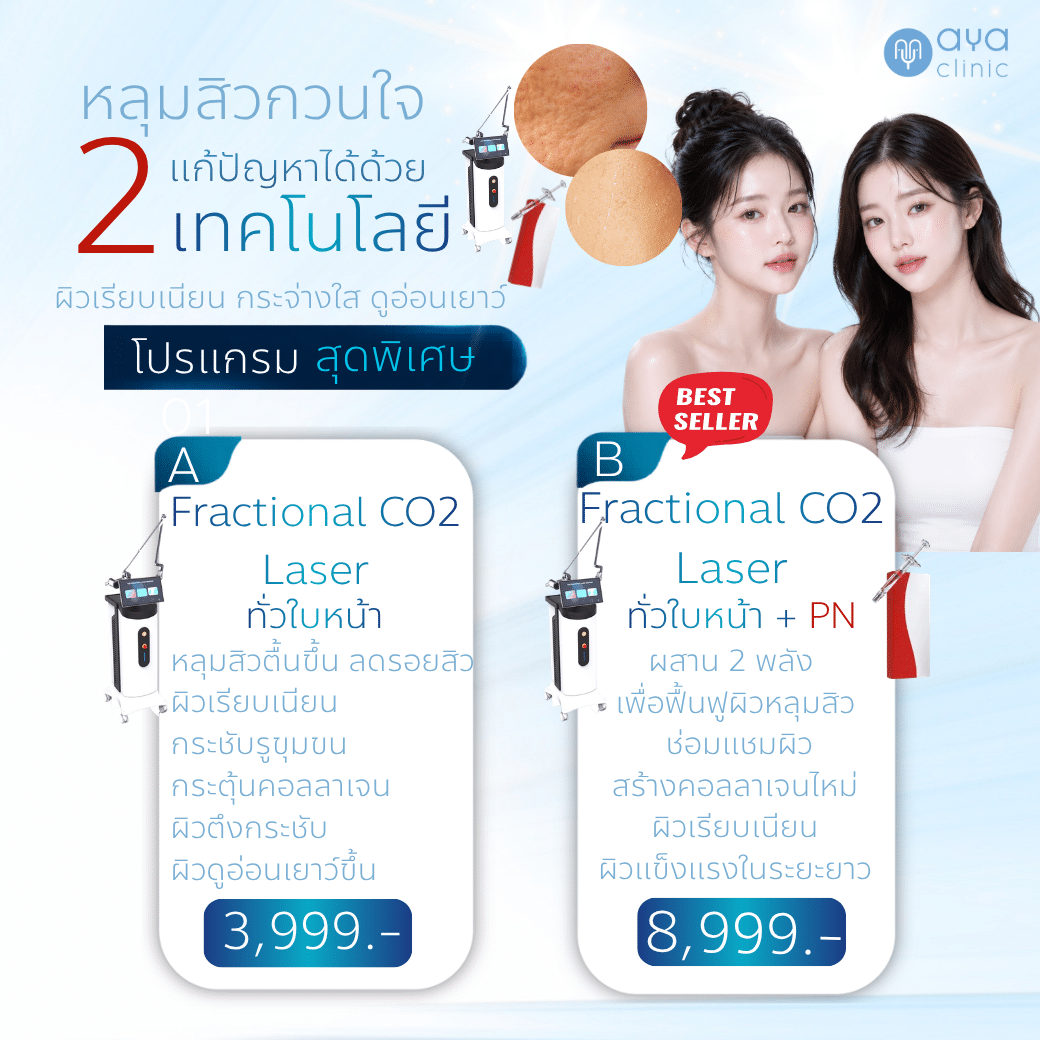 รักษาหลุมสิว ผิวเรียบเนียน