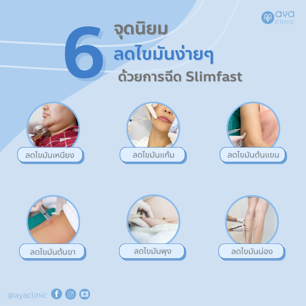 6 จุดนิยมฉีดสลายไขมัน Slim fast