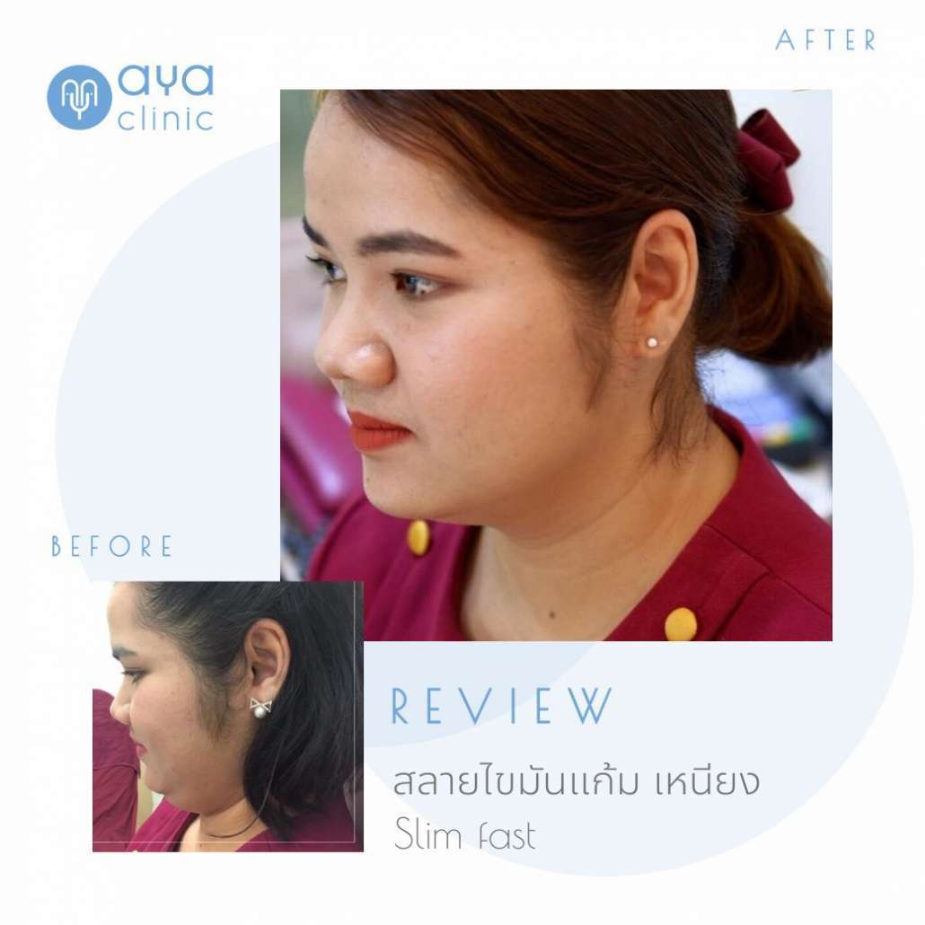 Makeover รีวิว