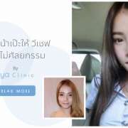 ปรับหน้าเรียว
