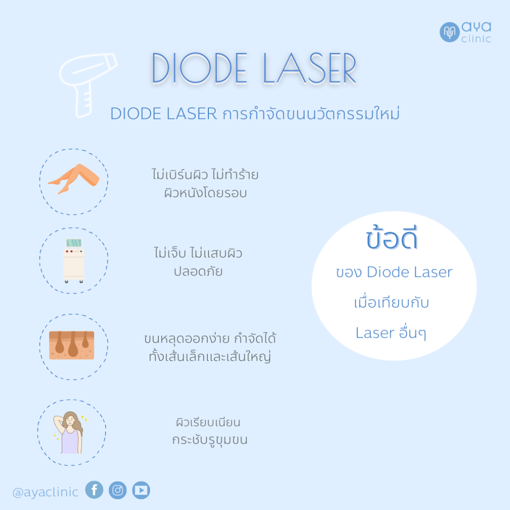 ข้อดีของการทำ Diode Laser