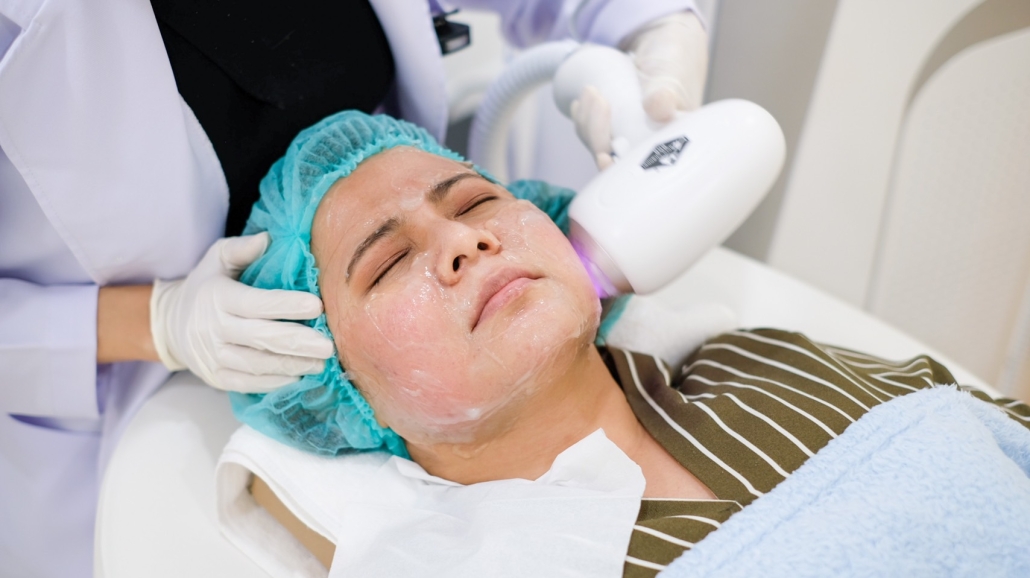ทำ Diode Laser กำจัดขนบริเวณใบหน้า