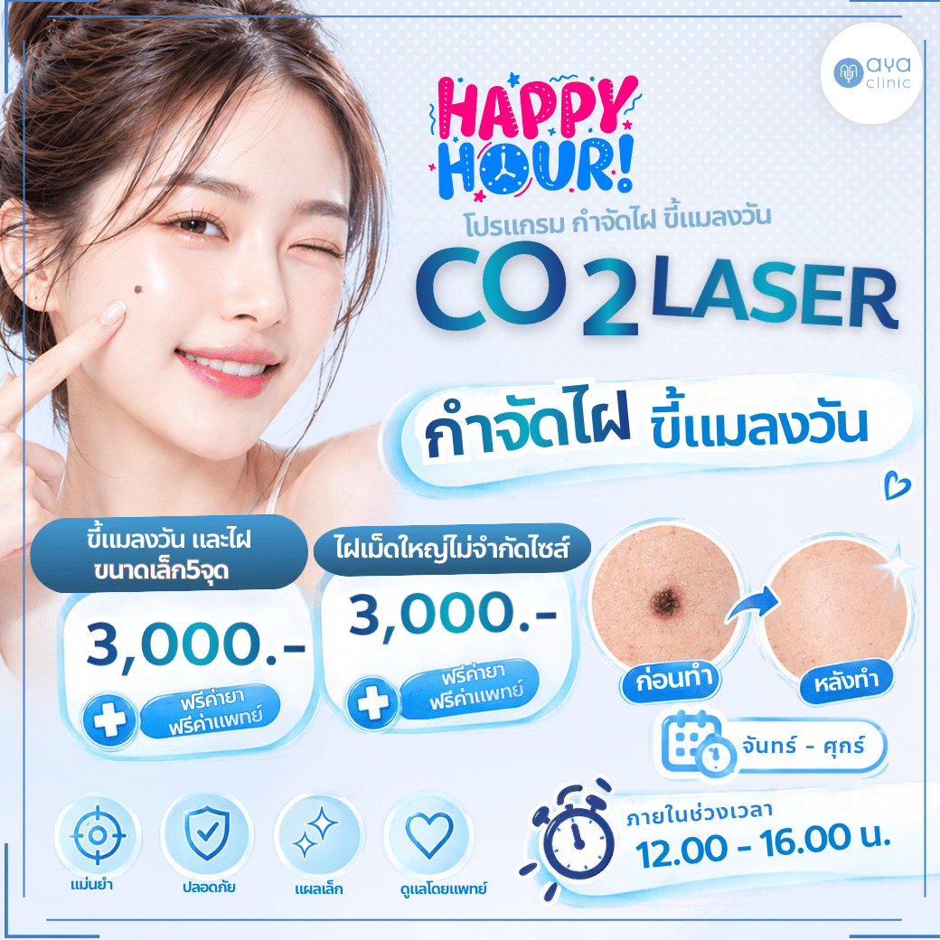 Co2 laser ขี้แมลงวัน
