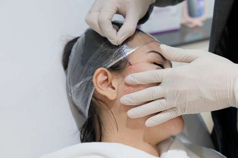 ดึงหน้าร้อยไหม