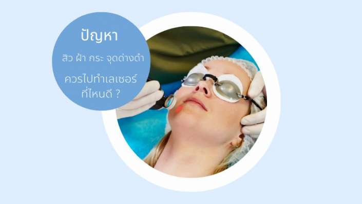 เลเซอร์หน้าใสที่ไหนดี