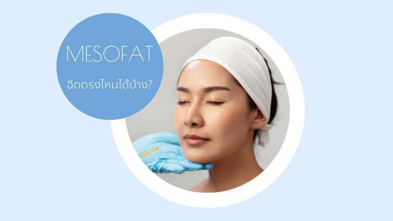 ฉีดเมโสแฟตราคา