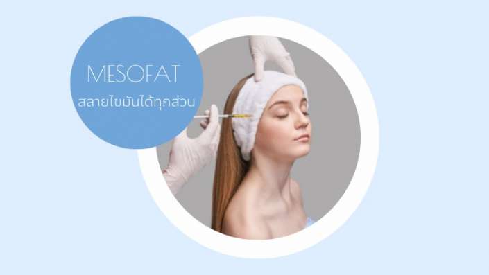 ฉีดเมโสแฟตราคา