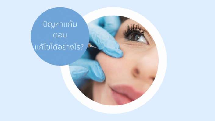 ฉีดฟิลเลอร์แก้มตอบ