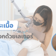 กระเนื้อคืออะไร