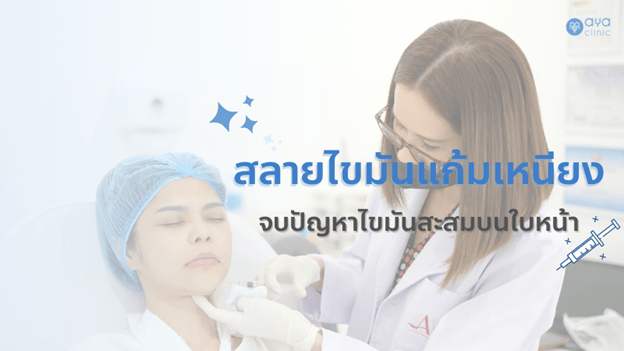 ฉีดลดเหนียง