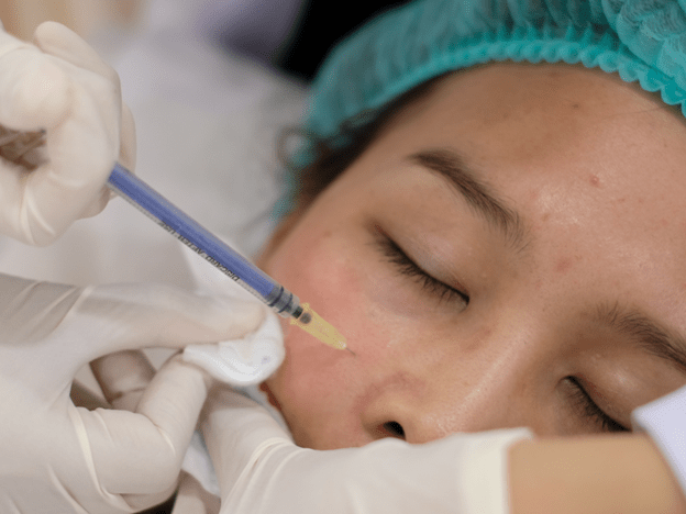 ฉีดเมโส