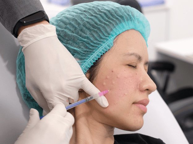 การฉีดเมโสคืออะไร