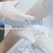 การสลายไขมันเฉพาะส่วน