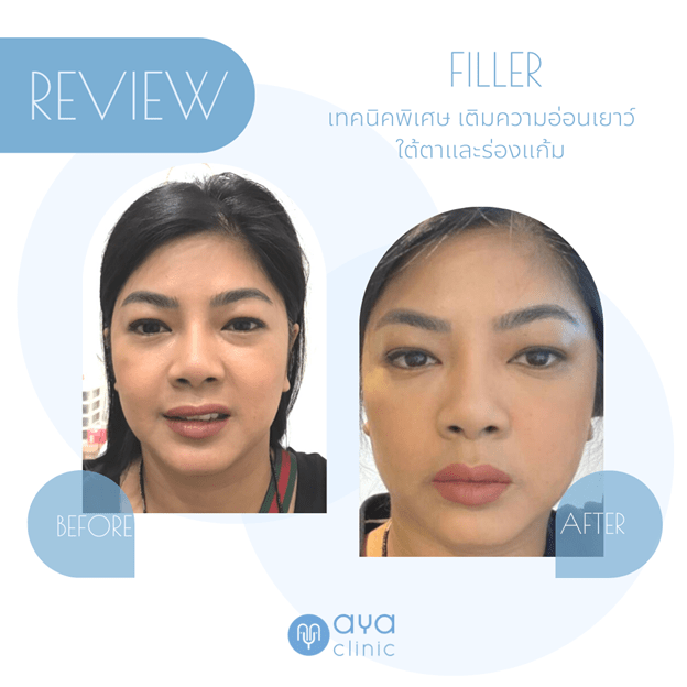 แก้มตอบเกิดจากอะไร