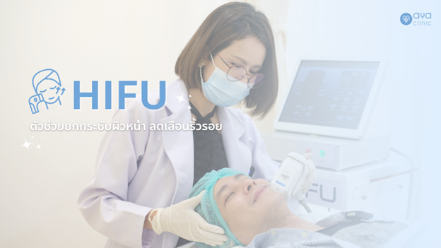 Hifu คืออะไร