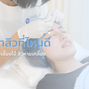 รักษาสิวที่ไหนดี