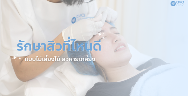 รักษาสิวที่ไหนดี