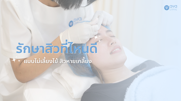 รักษาสิวที่ไหนดี