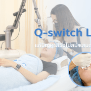 Q-switch laser