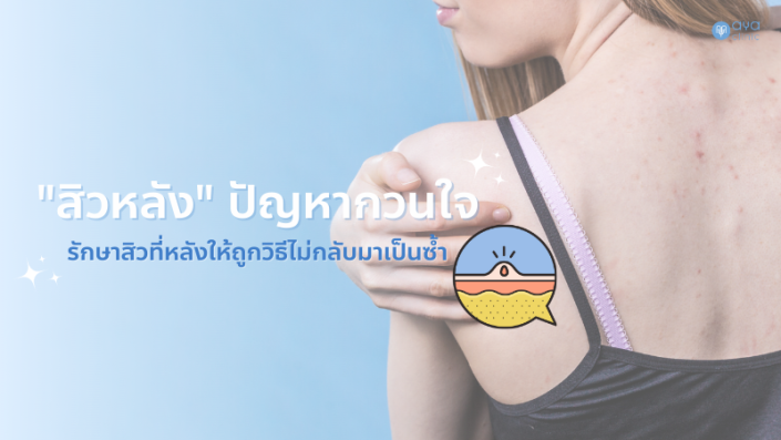 สิวหลังปัญหากวนใจ ที่รักษาได้