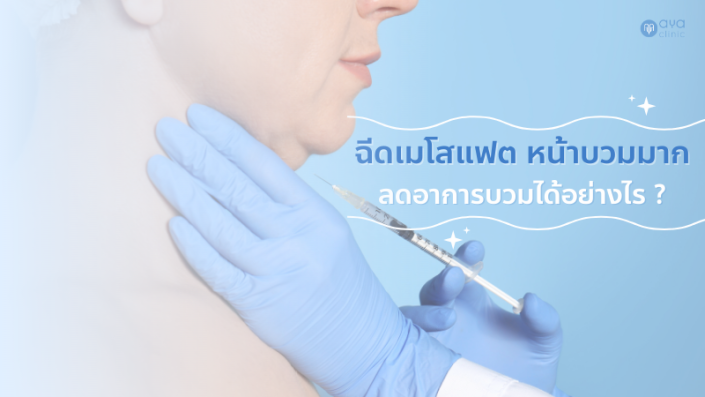 ฉีดเมโสแฟตหน้าบวมมาก มีวิธีลดอย่างไร