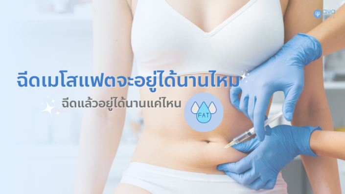 ฉีดเมโสแฟตอยู่ได้นานแค่ไหน