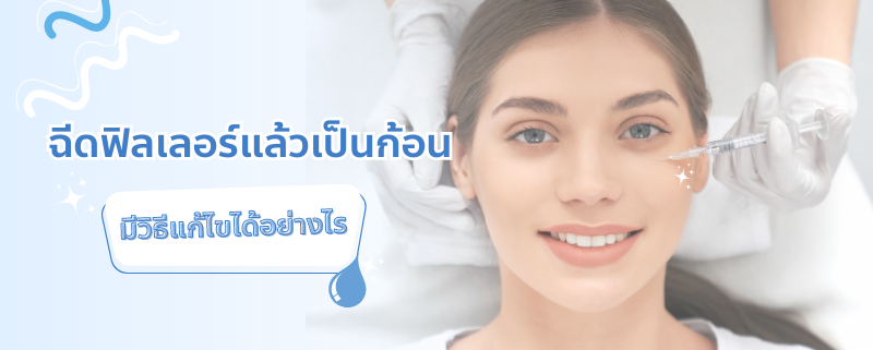 ฉีดฟิลเลอร์เป็นก้อน เกิดจากอะไร