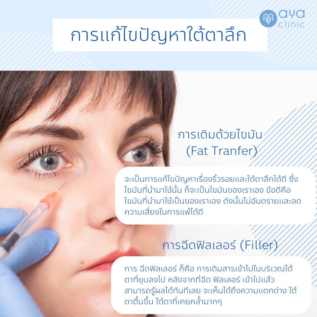 ฉีดฟิลเลอร์ใต้ตา