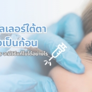 ฉีดฟิลเลอร์ใต้ตาแล้วเป็นก้อน