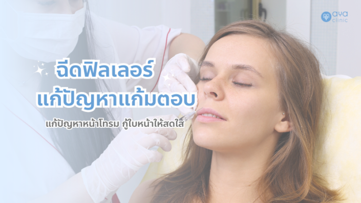 ฟิลเลอร์แก้มตอบ