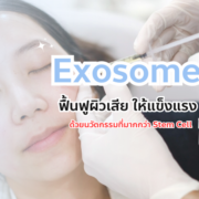 Exosome