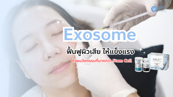 Exosome