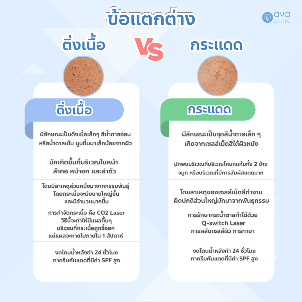 ติ่งเนื้อ กระแดด