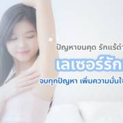 เลเซอร์กำจัดขนรักแร้